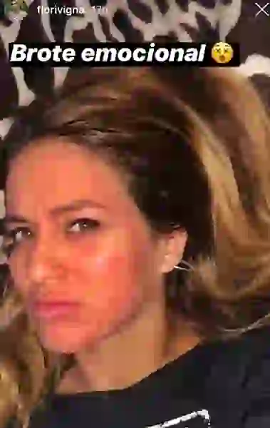 La separación afectó la piel del rostro de Flor.