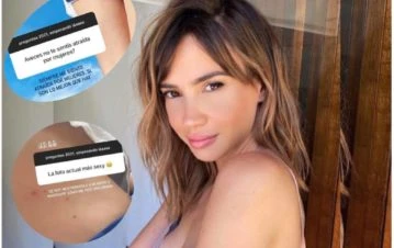 ¡No apto para sensibles! Cómo le quedó la panza a Celeste Cid tras ser picada por una araña