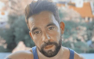 ¡Terrible! Cómo le quedó la piel a Cachete Sierra después de sufrir un doloroso accidente doméstico