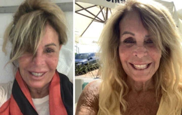 La sorprendente recuperación de Pata Villanueva después de haber estado cerca de la muerte