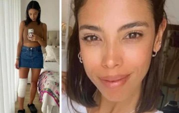 ¡Dramático! Maypi Delgado tuvo que ser operada tras accidentarse practicando wakeboard