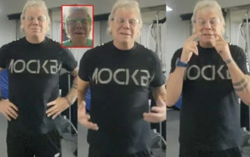 Beto Casella habló de los problemas que tiene en su nariz: "Lo que parecía un granito era un quiste maligno"