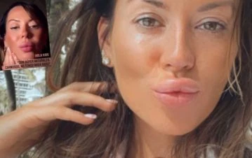 ¡Re podrida! El polémico descargo de Karina Jelinek contra quienes la critican por sus labios carnosos: “Son así, no tienen…”