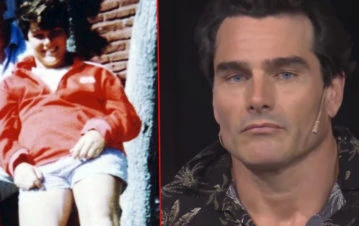 El antes y después de Hernán Drago en fotos: del bullying de adolescente al éxito total