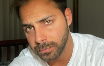 ¡Impactante! El video de la cirugía de implante capilar que se hizo Grego Rossello