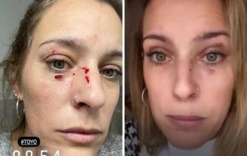 ¡Qué dolor! Dani La Chepi fue atacada por su gato y quedó con la cara destrozada: el video