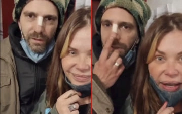 El novio de Nazarena Vélez relato el grave accidente que sufrió