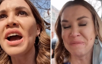 El impresionante video de Dallys Ferreyra mientras es agredida en la calle