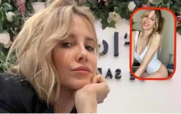 Cómo es y cuánto cuesta el tratamiento que se hace Guillermina Valdés contra la celulitis en las piernas