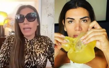 El impactante relato de Flor de la V luego de su quinta operación mamaria: “No podía creer que tenía eso en el cuerpo”