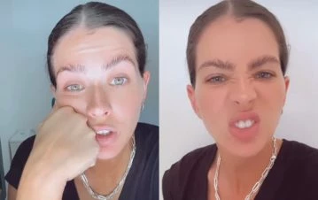 Cómo le quedó la cara a la China Suárez después del doloroso accidente que sufrió en la piscina de su casa