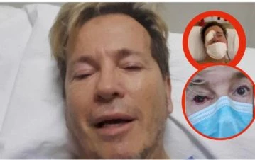 ¡Exclusivo! Guido Suller, operado de urgencia y con temor a perder la vista: “Me vaciaron el ojo, me llenaron con gas y…”