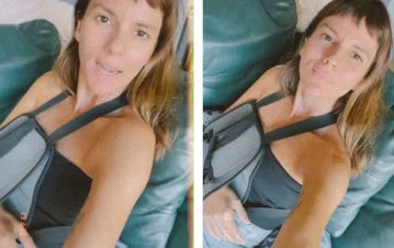 Doloroso: Gimena Accardi mostró cómo quedó su hombro a 15 días de haberse operado
