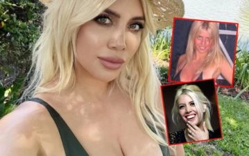 ¡Sólo la verdad! Wanda Nara habló a fondo de sus cirugías y cambios estéticos y blanqueó si se operó las lolas a los 15
