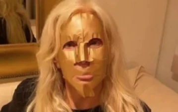 Los sorprendentes resultados del tratamiento estético que se hizo Susana Giménez con "mascarilla de oro"