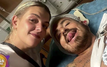 La primera foto de Fede Bal tras ser operado en Brasil: "Arreglaron el hueso y pusieron chapas y clavos"