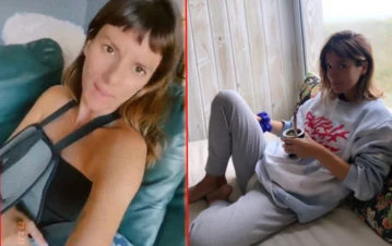 Gimena Accardi mostró por primera vez cómo estaba su brazo tras el grave accidente