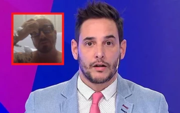 Fede Bal mostró cómo quedó su brazo y Rodrigo Lussich le hizo una pregunta sin filtro: "¿Tus ex te..."