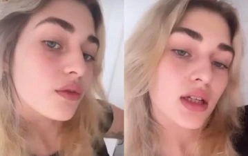 Martita Fort mostró qué cirugía se hizo en la cara: ”Siempre fue una inseguridad mía”