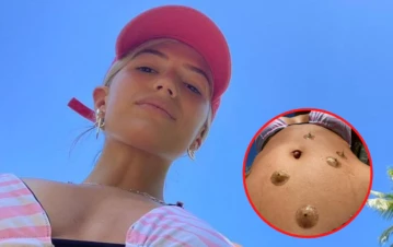 Stefi Roitman compartió impactantes imágenes de su panza y explotaron las preguntas: "¿Qué es eso?"