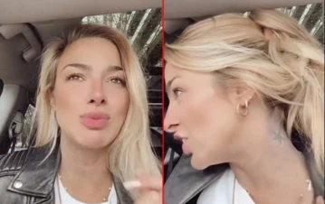 Ailén Bechara usó un remedio casero de su abuela y quedó con la piel manchada de azul