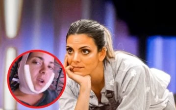 Belu Lucius pasó por el quirófano y se hizo un doloroso cambio estético