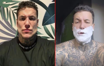El video de Alex Caniggia mostrando su nueva cara tras operarse: “Cada día estoy más facha y…”