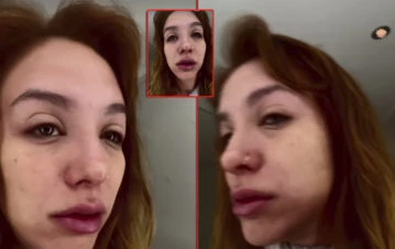 La sorpresiva reacción de Luciano Castro cuando vio a Flor Vigna con la cara hinchada: "Te agarró un..."