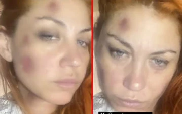 La ex Bandana Lowrdez denunció a su pareja por violencia de género con un impactante video: "El amor no duele"