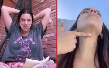 Belu Lucius mostró cómo le quedó la "papada" a un mes de haberse sometido a un retoque estético