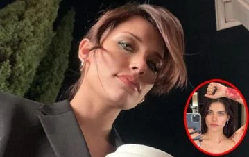 Eva de Dominici mostró cómo le quedó su piel a un año de haber tenido un grave accidente en Los Angeles