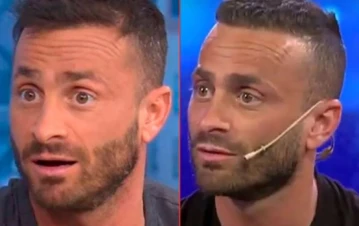 Martín Baclini se realizó retoques estéticos y está irreconocible: las fotos