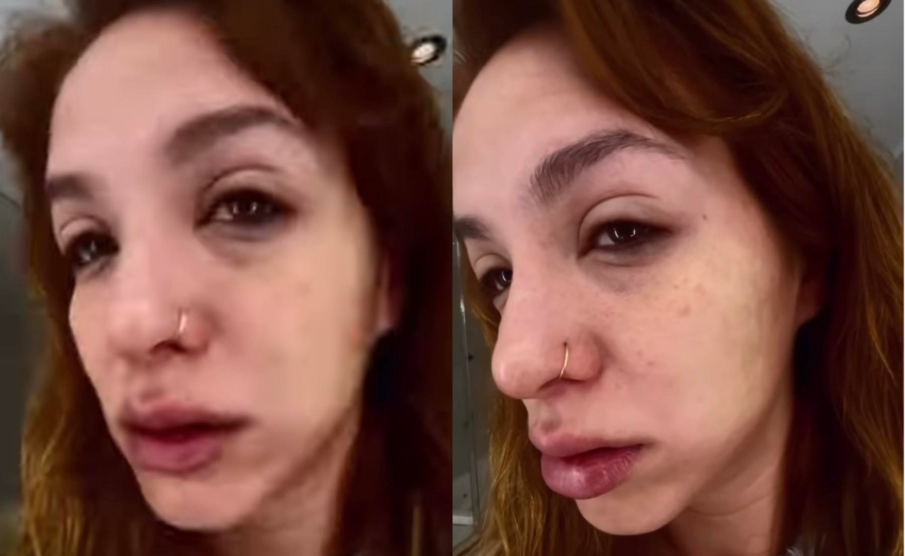 Flor Vigna preocupó a todo el mundo al compartir un video con su rostro desfigurado: qué le pasó
