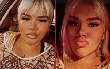 Morena Rial mostró cómo está tras tres cirugías estéticas en los últimos días