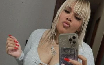 More Rial publicó una foto subida de tono y mostró las cicatrices de su cirugías