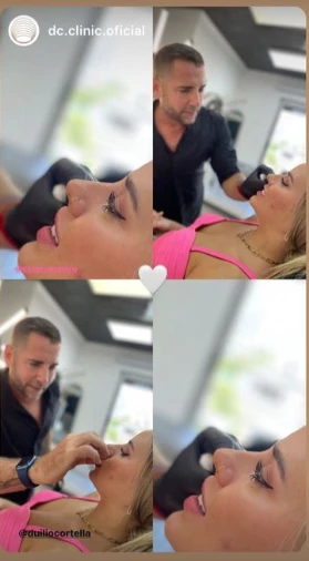 Coti se aplicó unas técnicas en el rostro