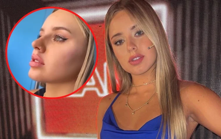 Coti se hizo los labios