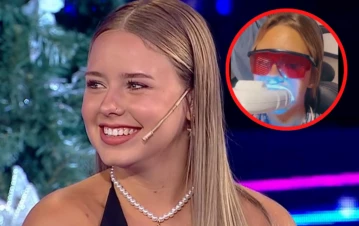 Coti Romero se hizo un nuevo retoque estético y mostró el paso a paso