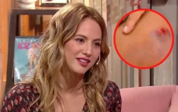 ¡Las imágenes! El durísimo accidente que sufrió Florencia Vigna en la calle: "Me podría haber matado"