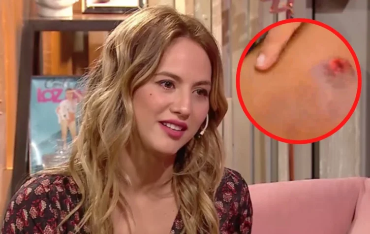 Florencia Vigna y el duro accidente.