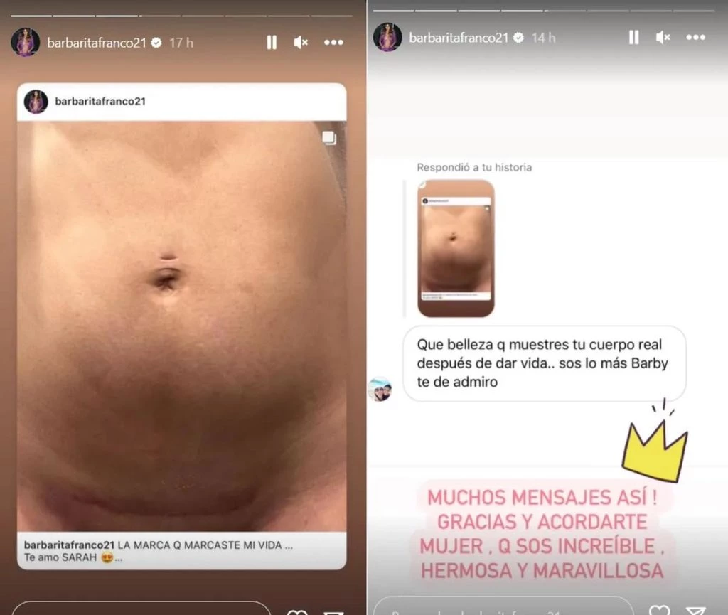 La cesárea de Barby