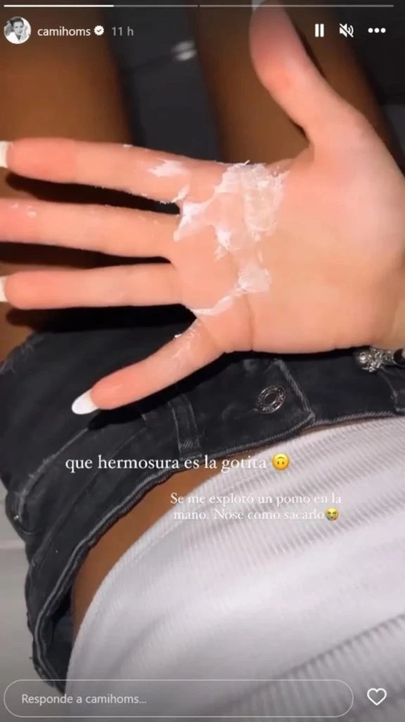 Homs-accidente-domestico