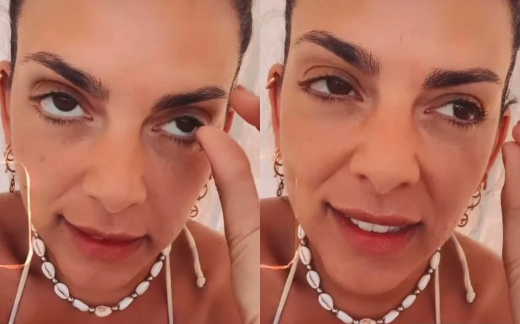 Belu y su fobia a los piojos