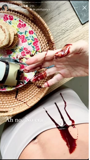 El accidente de Zaira Nara