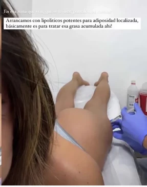 Camila Mayan y su retoque estetico