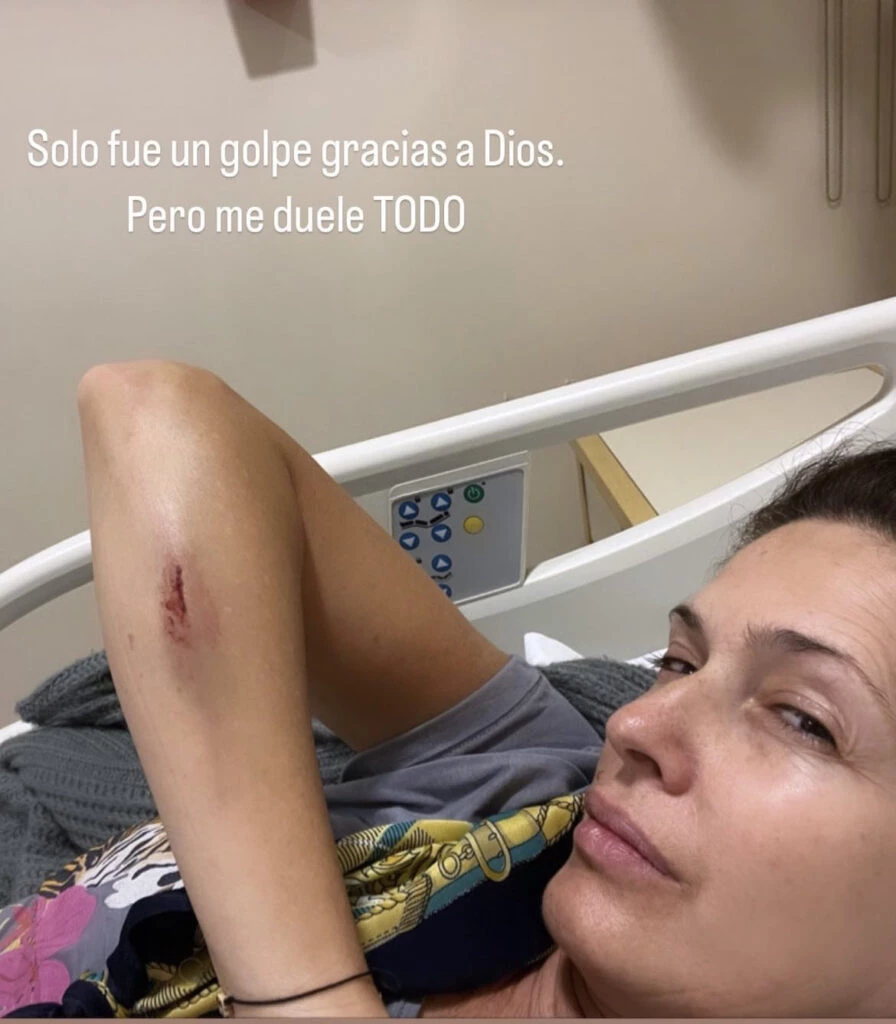 ISABEL MACEDO QUEDO CON EL BRAZO MAGULLADO.