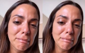 Belu Lucius mostró cual fue la cicatriz que le quedó tras la operación