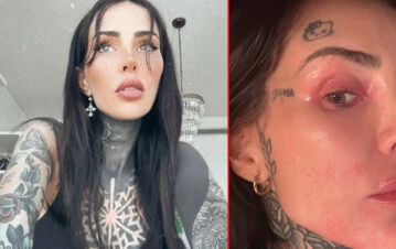 Cande Tinelli sufre un problema de salud grave y pidió ayuda desde Europa