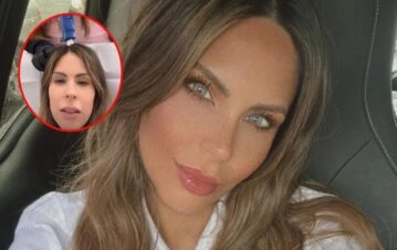 Barby Franco inició un curioso tratamiento para detener la caída del pelo