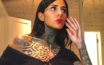 Cande Tinelli se sometió a un polémico tratamiento de belleza que utiliza su propia sangre: “Sagrado plasma que…”